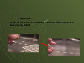 SPREADING
- used for thick mucoid secretions (smears of fresh sputum and
bronchial aspirates)
 