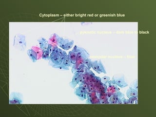 Cytoplasm – either bright red or greenish blue
vesicular nucleus – blue
pyknotic nucleus – dark blue to black
 