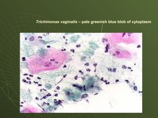 Trichimonas vaginalis – pale greenish blue blob of cytoplasm
 