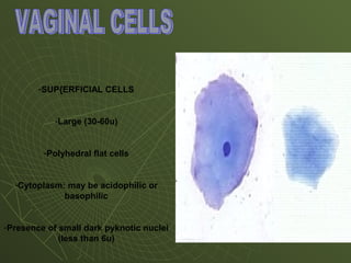 -SUP{ERFICIAL CELLS
-Large (30-60u)
-Polyhedral flat cells
-Cytoplasm: may be acidophilic or
basophilic
-Presence of small dark pyknotic nuclei
(less than 6u)
 