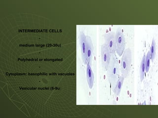 INTERMEDIATE CELLS
-
medium large (20-30u)
-
Polyhedral or elongated
-
Cytoplasm: basophilic with vacuoles
-
Vesicular nuclei (6-9u)
 