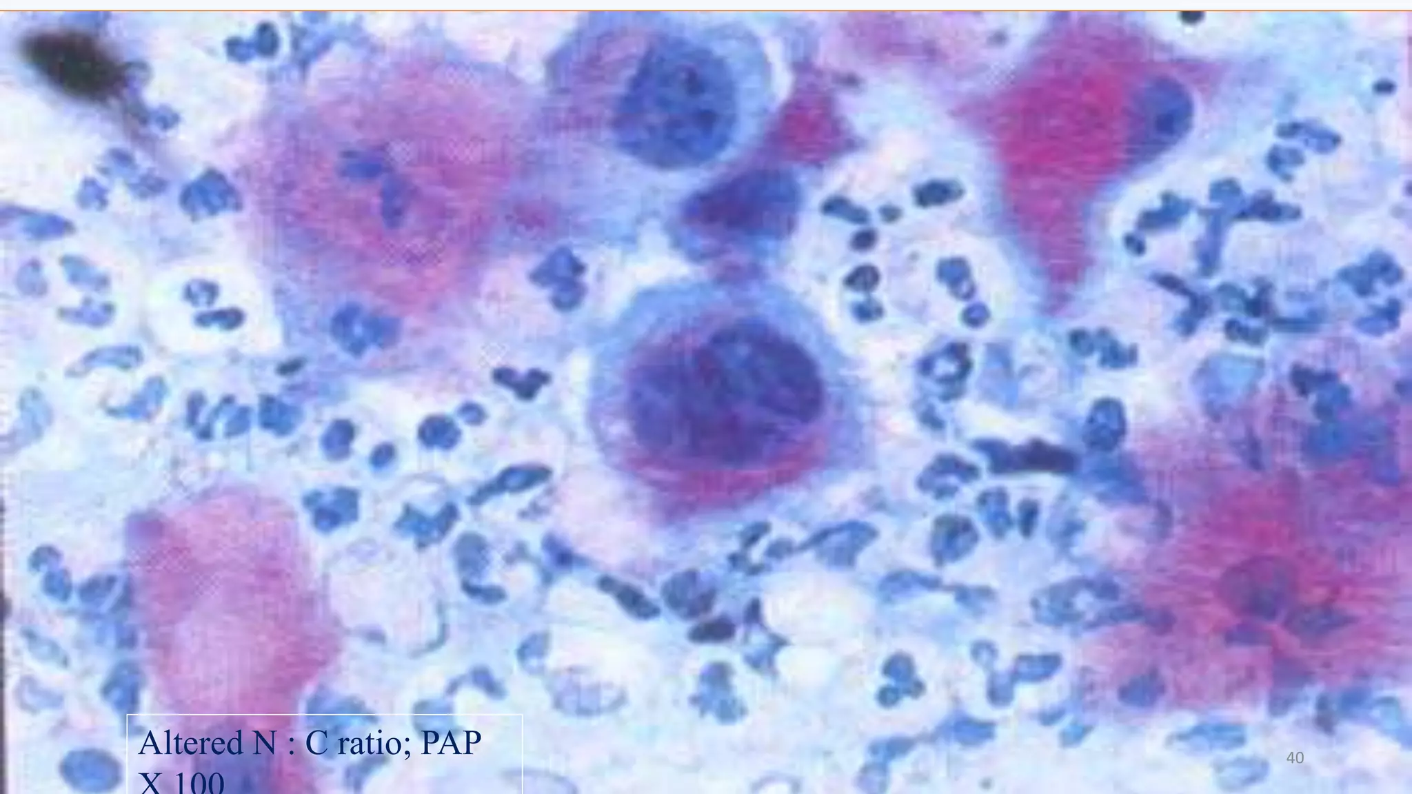 Exfoliative Cytology PPTX Exfoliative Cytology PPTX