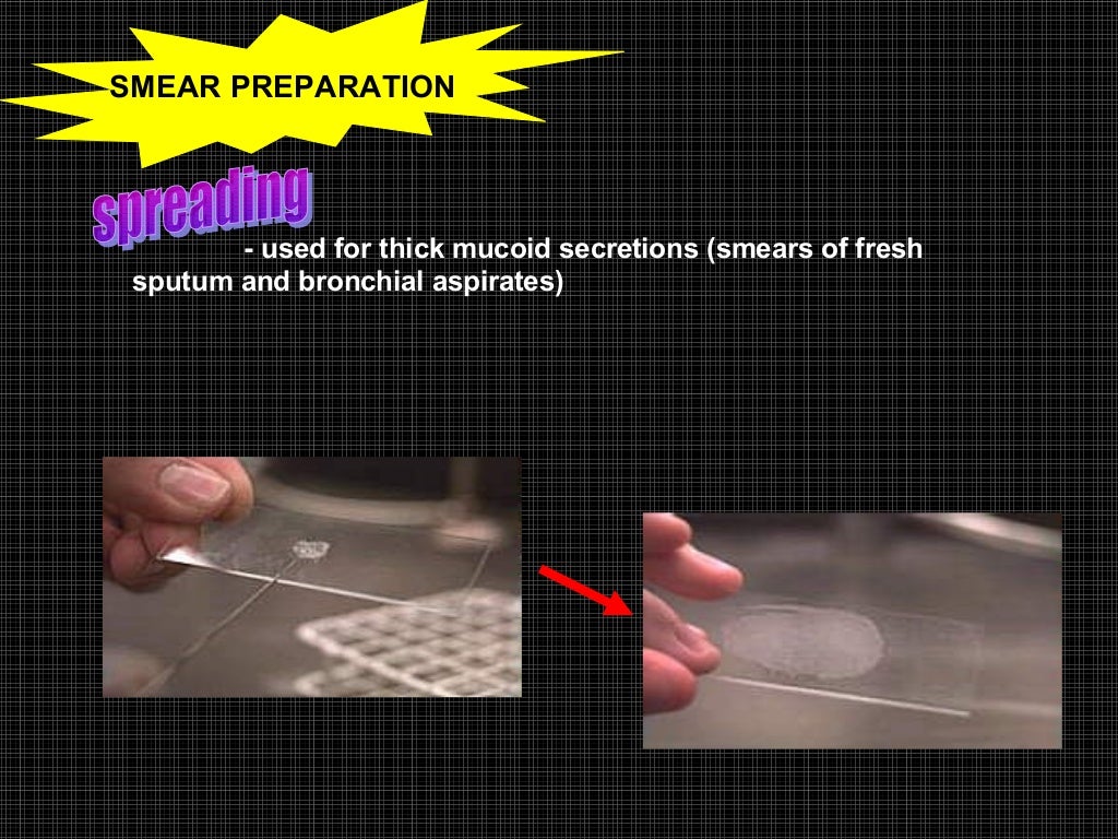 Exfoliative cytology