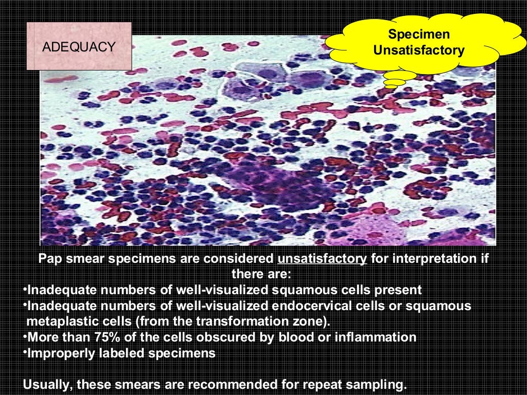 Exfoliative cytology