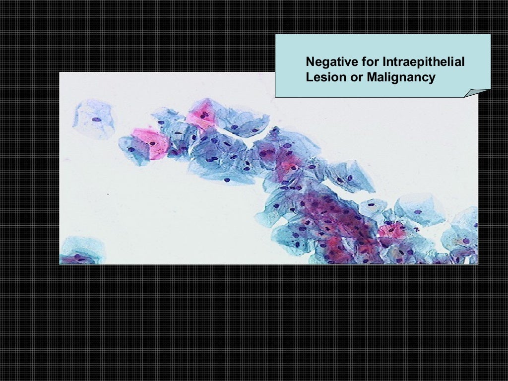 Exfoliative cytology