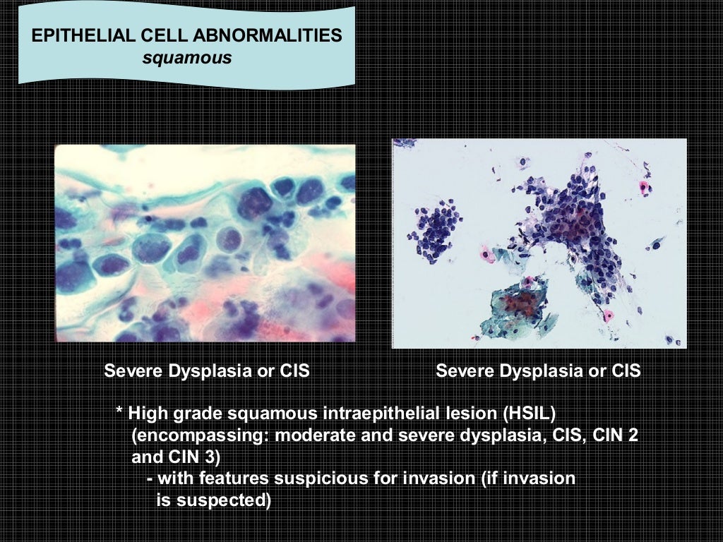 Exfoliative cytology