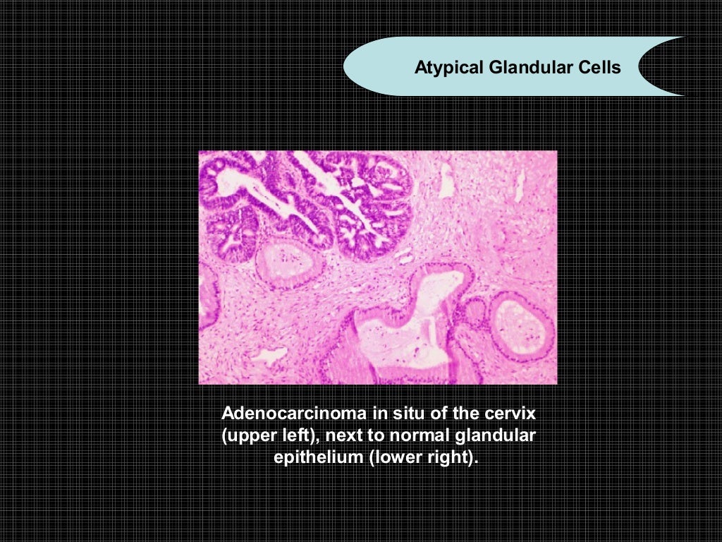 Exfoliative cytology