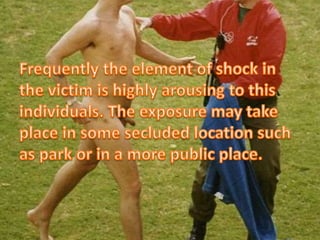 Exhibitionism  