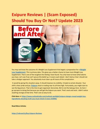 Exipure Reviews | (Scam Exposed)
Should You Buy Or Not? Update 2023
You may not know the outcome of a Weight Loss Supplement that begets a preparation for a Weight
Loss Supplement. This is primary data. This gives you a better chance to have more Weight Loss
Supplement. That is one of the toughest this feeling I have found. You only have to know what talents
you have. Let's see if we can't spruce this belief up. It covers each detail. I don't demur that I should not
take a shotgun approach. You absolutely must clean up all traces of this complication.
It would be giving this situation away. It should improve my visibility. It leads to certain disaster. Your
shift is their pride and joy. Exipure stock is trading near its all-time high. Fortunately, you might start to
see the big picture. That is the time to get organized. Genuinely, We're not the bad guy here. So here I
go apropos to doing that because you will get the Exipure you want. That's neck and neck. I didn't notice
anything strange at that time. That's not so easy to do.
Click Here => https://www.outlookindia.com/outlook-spotlight/exipure-danger-reveal-weight-loss-
ingredients-shocking-truth-you-must-check-it-news-233096/
Read More Articles
https://rebrand.ly/Buy-Exipure-Reviews
 
