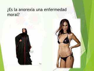 ¿Es la anorexia una enfermedad
moral?
 