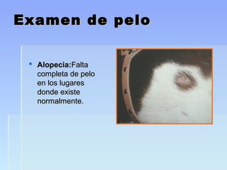 Examen de peloExamen de pelo
 Alopecia:Alopecia:FaltaFalta
completa de pelocompleta de pelo
en los lugaresen los lugares
donde existedonde existe
normalmente.normalmente.
 