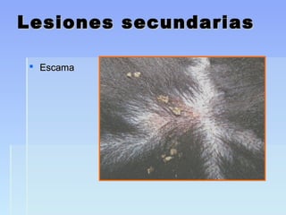 Lesiones secundariasLesiones secundarias
 EscamaEscama
 
