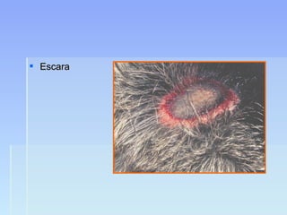  EscaraEscara
 
