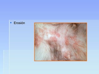  ErosiónErosión
 