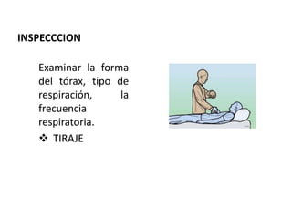 INSPECCCION
Examinar la forma
del tórax, tipo de
respiración, la
frecuencia
respiratoria.
 TIRAJE
 