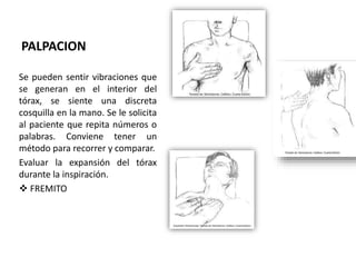 PALPACION
Se pueden sentir vibraciones que
se generan en el interior del
tórax, se siente una discreta
cosquilla en la mano. Se le solicita
al paciente que repita números o
palabras. Conviene tener un
método para recorrer y comparar.
Evaluar la expansión del tórax
durante la inspiración.
 FREMITO
 