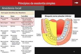 16
Princípios da exodontia simples
Anestesia local
Bloqueio nervo alveolar inferior
 