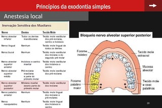 20
Princípios da exodontia simples
Anestesia local
Bloqueio nervo alveolar superior posterior
 