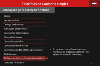 Cáries
Necrose pulpar
Doença periodontal
Indicações ortodônticas
Dentes mal posicionados
Dentes fraturados
Dentes impactados
Dentes supranumerários
Dentes associados a lesões patológicas
Radioterapia
Dentes envolvidos em fraturas dos maxilares
Questões financeiras 34
Princípios da exodontia simples
Indicações para extração dentária
• Os pacientes que sofreram fratura na
mandíbula ou processo alveolar as vezes
devem ter os dentes removidos;
 