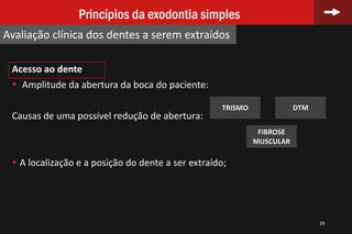 Acesso ao dente
 Amplitude da abertura da boca do paciente:
Causas de uma possível redução de abertura:
 A localização e a posição do dente a ser extraído;
39
Princípios da exodontia simples
Avaliação clínica dos dentes a serem extraídos
TRISMO DTM
FIBROSE
MUSCULAR
 