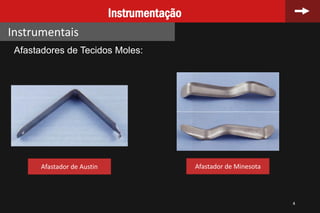 4
Instrumentação
Instrumentais
Afastadores de Tecidos Moles:
Afastador de Austin Afastador de Minesota
 