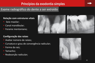 Relação com estruturas vitais
 Seio maxilar;
 Canal mandibular;
 Forame mentoniano;
Configuração das raízes
 Avaliar número de raízes;
 Curvatura e grau de convergência radicular;
 Forma da raiz;
 Tamanho;
 Reabsorção radicular;
42
Princípios da exodontia simples
Exame radiográfico do dente a ser extraído
 
