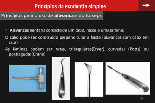  Alavancas dentária consiste de um cabo, haste e uma lâmina;
O cabo pode ser construído perpendicular a haste (alavancas com cabo em
cruz)
As lâminas podem ser retas, triangulares(Cryer), curvadas (Potts) ou
pontiagudas(Crane);
50
Princípios da exodontia simples
Princípios para o uso de alavanca e do fórceps
 