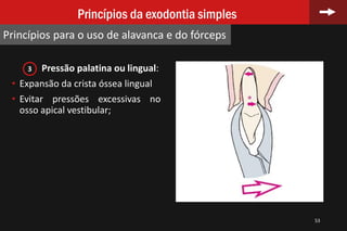 Pressão palatina ou lingual:
• Expansão da crista óssea lingual
• Evitar pressões excessivas no
osso apical vestibular;
53
Princípios da exodontia simples
Princípios para o uso de alavanca e do fórceps
3
 