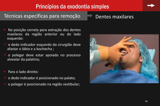 66
Princípios da exodontia simples
Técnicas específicas para remoção Dentes maxilares
 Na posição correta para extração dos dentes
maxilares da região anterior ou do lado
esquerdo:
 o dedo indicador esquerdo do cirurgião deve
afastar o lábio e a bochecha ;
 o polegar deve estar apoiado no processo
alveolar da palatina;
 Para o lado direito:
 o dedo indicador é posicionado no palato;
 o polegar é posicionado na região vestibular;
 