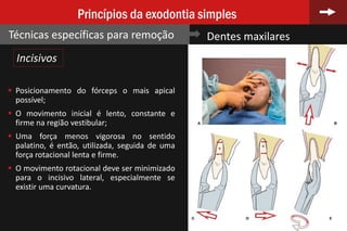 68
Princípios da exodontia simples
Técnicas específicas para remoção Dentes maxilares
 Posicionamento do fórceps o mais apical
possível;
 O movimento inicial é lento, constante e
firme na região vestibular;
 Uma força menos vigorosa no sentido
palatino, é então, utilizada, seguida de uma
força rotacional lenta e firme.
 O movimento rotacional deve ser minimizado
para o incisivo lateral, especialmente se
existir uma curvatura.
Incisivos
 