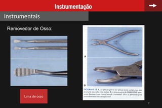 7
Instrumentação
Instrumentais
Removedor de Osso:
Lima de osso
 