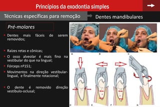 82
Princípios da exodontia simples
Técnicas específicas para remoção Dentes mandibulares
Pré-molares
 Dentes mais fáceis de serem
removidos;
 Raízes retas e cônicas;
 O osso alveolar é mais fino na
vestibular do que na lingual;
 Fórceps nº151;
 Movimentos na direção vestibular-
lingual, e finalmente rotacional;
 O dente é removido direção
vestíbulo-oclusal;
 