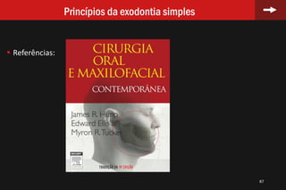 87
Princípios da exodontia simples
 Referências:
 