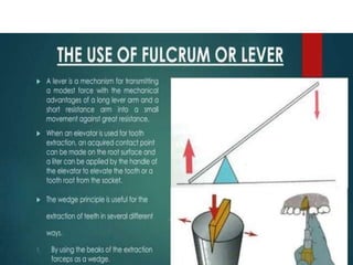 EXODONTIA -   PRINCIPLES AND TECHNIQUES.