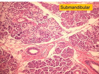Submandibular
 