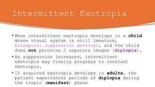 Exodeviations and exotropia of the eye final | POTX
