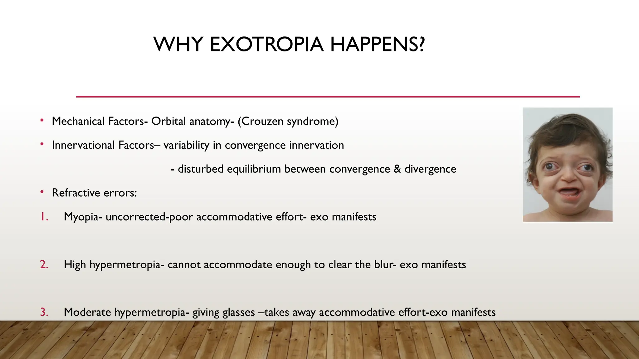 WHY EXOTROPIA HAPPENS?
• Mechanical Factors- Orbital anatomy- (Crouzen syndrome)
• Innervational Factors– variability in convergence innervation
- disturbed equilibrium between convergence & divergence
• Refractive errors:
1. Myopia- uncorrected-poor accommodative effort- exo manifests
2. High hypermetropia- cannot accommodate enough to clear the blur- exo manifests
3. Moderate hypermetropia- giving glasses –takes away accommodative effort-exo manifests
 