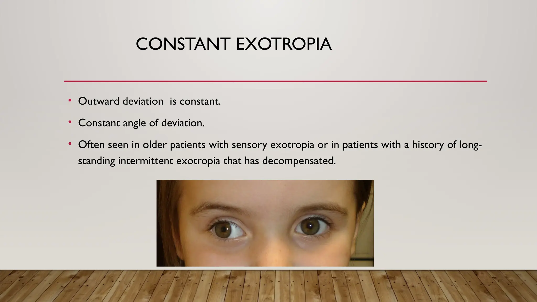 CONSTANT EXOTROPIA
• Outward deviation is constant.
• Constant angle of deviation.
• Often seen in older patients with sensory exotropia or in patients with a history of long-
standing intermittent exotropia that has decompensated.
 