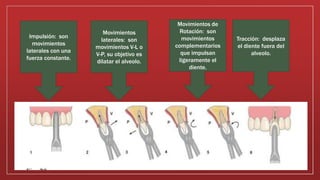 Impulsión: son
movimientos
laterales con una
fuerza constante.
Movimientos
laterales: son
movimientos V-L o
V-P, su objetivo es
dilatar el alveolo.
Movimientos de
Rotación: son
movimientos
complementarios
que impulsan
ligeramente el
diente.
Tracción: desplaza
el diente fuera del
alveolo.
 