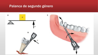 Palanca de segundo género
 