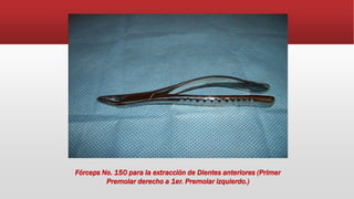 Fórceps No. 150 para la extracción de Dientes anteriores (Primer
Premolar derecho a 1er. Premolar izquierdo.)
 