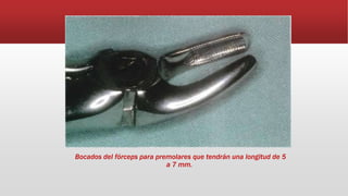 Bocados del fórceps para premolares que tendrán una longitud de 5
a 7 mm.
 