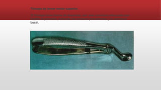 Fórceps de tercer molar superior.
El fórceps tiene forma de bayoneta, con una curvatura adecuada que
facilite la prensión, evitando los molares precedentes y la comisura
bucal.
 