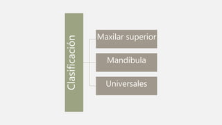 Clasificación
Maxilar superior
Mandíbula
Universales
 