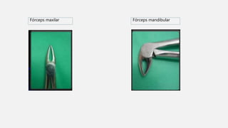 Fórceps maxilar Fórceps mandibular
 