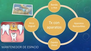 MANTENEDOR DE ESPACIO
Tx con
aparatos
Banda
y Asa
Aparatos
Removibles
Zapata
Distal
Arco
lingual
 