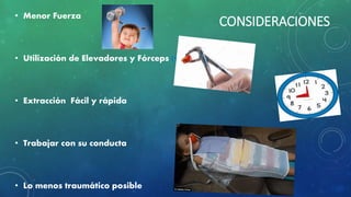 CONSIDERACIONES
• Menor Fuerza
• Utilización de Elevadores y Fórceps (ver tabla)
• Extracción Fácil y rápida
• Trabajar con su conducta
• Lo menos traumático posible
 