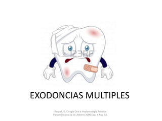 EXODONCIAS MULTIPLES
Raspall, G. Cirugìa Oral e Implantologìa. Medica
Panamericana 2a Ed.,febrero 2006.Cap. 4 Pag. 92.

 