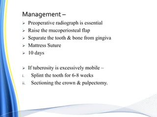 Management –
 Preoperative radiograph is essential
 Raise the mucoperiosteal flap
 Separate the tooth & bone from gingiva
 Mattress Suture
 10 days
 If tuberosity is excessively mobile –
i. Splint the tooth for 6-8 weeks
ii. Sectioning the crown & pulpectomy.
 