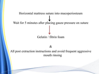 Horizontal mattress suture into mucoperiosteum
Wait for 5 minutes after placing gauze pressure on suture
Gelatin / fibrin foam
&
All post extraction instructions and avoid frequent aggressive
mouth rinsing
 